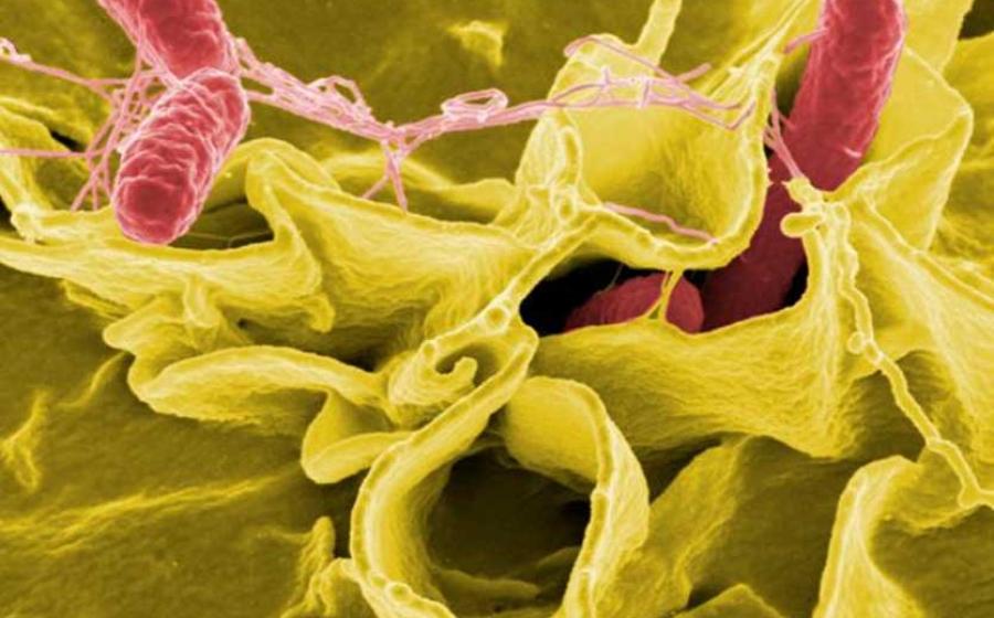 Salmonella bacteria, a common cause of foodborne disease, invade an immune cell.