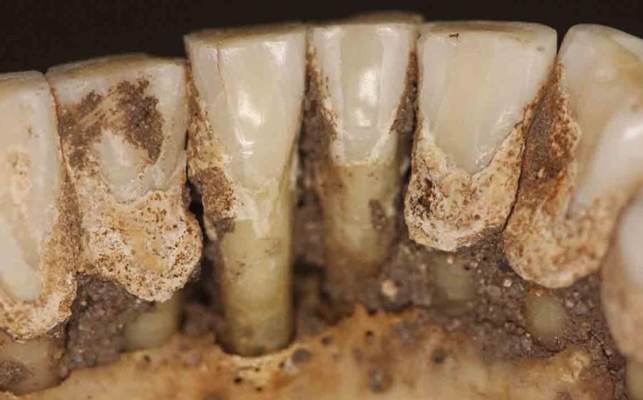 New study will help us understand more about ancient trippers by testing ancient teeth. Source: Line S. Larsen / Science