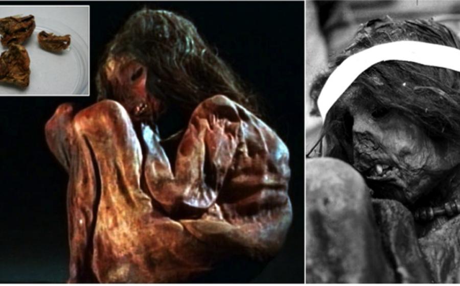 Photos of the child mummy that may have been sacrificed in a ritual of Capacocha. Above left, detail of the mummy’s dissected lung. A small sample of 350 milligrams (0.01 ounces) was used to extract DNA in the current study.