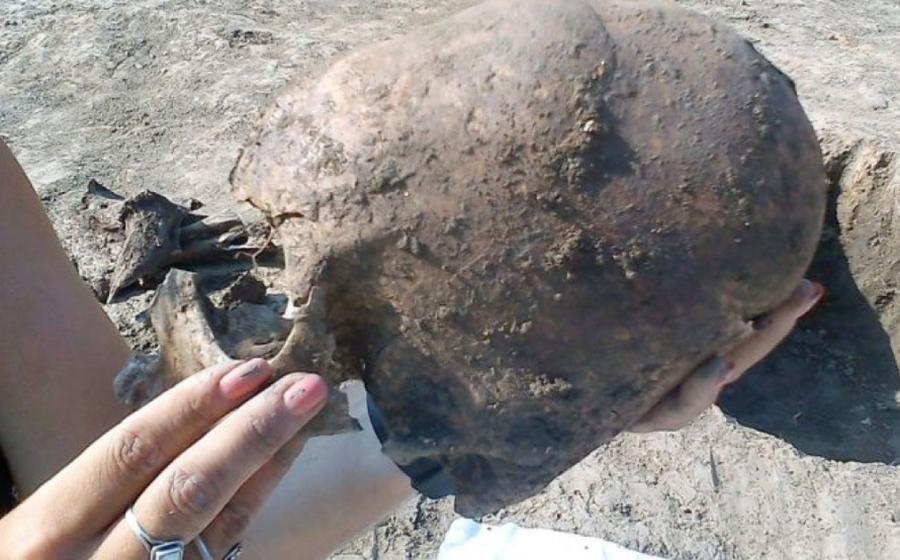 One of the two elongated skulls belongs to a teenage boy who died 1500 years ago and was buried in a pit with two other boys of different genetic background.     Source: © D. Los/Kaducej Ltd / University of Wien