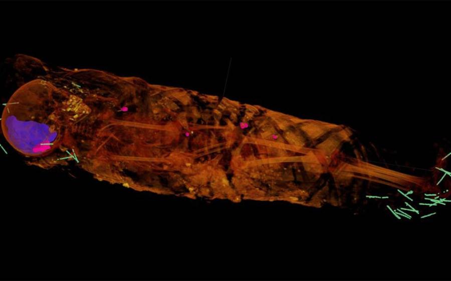 Tech Reveals A Little Girl Mummy Who Doesn’t Look Like Her Portrait