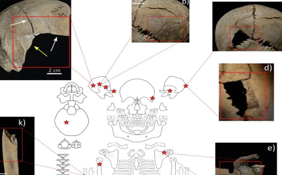 Distribution and examples of perimortem skeletal lesions at Cornaux