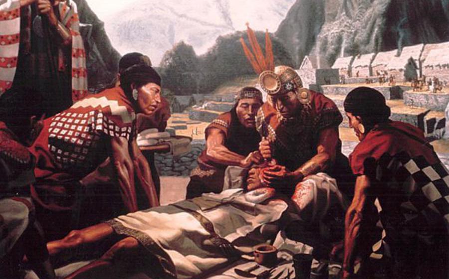 Artist’s rendition of Inca skull surgery. Credit: ThomasH