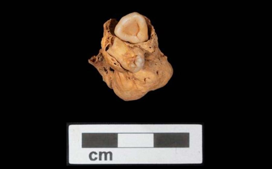 The teratoma tumor, including teeth, which was discovered within the Amarna crypt. Source: A. Deblauwe / Amarna Project