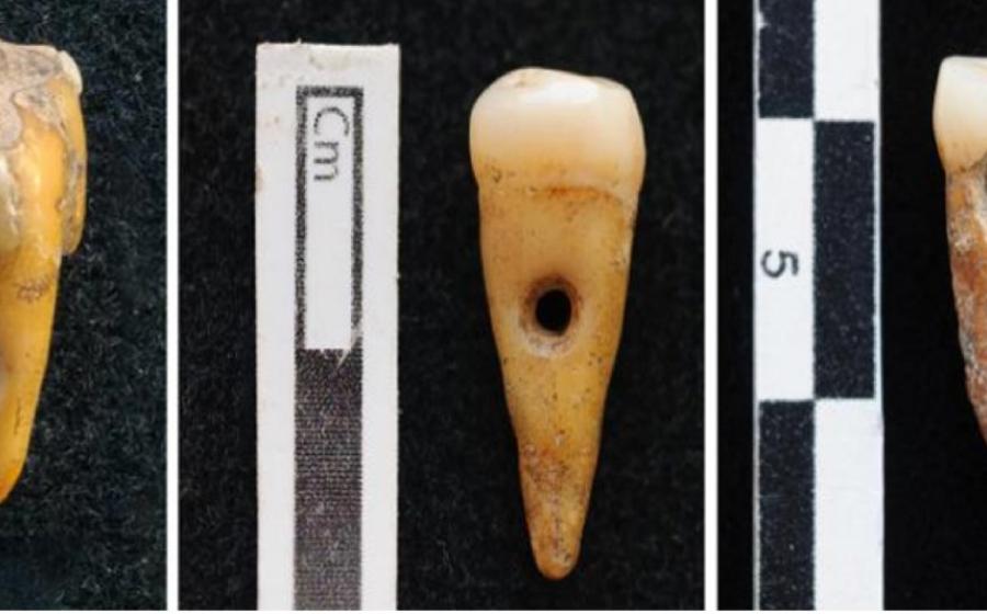 Evidence of human tooth jewelry has been found at Çatalhöyük, Turkey. Source: SCOTT HADDOW / UNIVERSITY OF COPENHAGEN