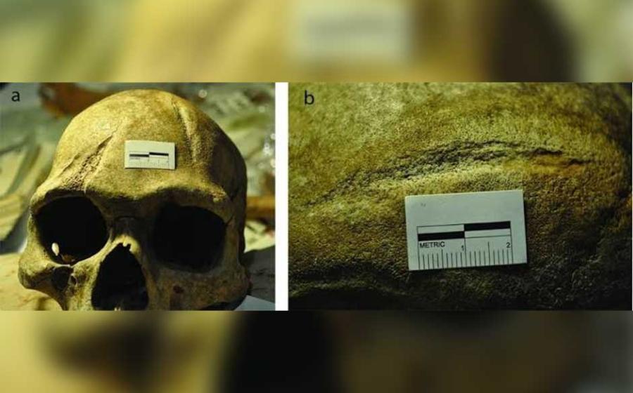 Skull
