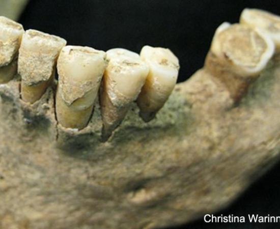 1,000-year-old tooth plaque
