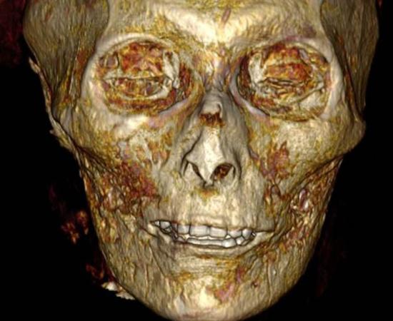In a new breakthrough, scientists have digitally scanned the sarcophagus of pharaoh Amenhotep I to reveal a stunning image of his actual head and body.		Source: S. Saleem and Z. Hawass / Frontiers in Medicine