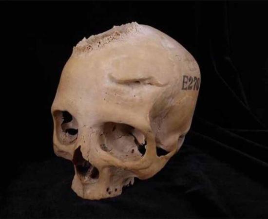 Skull E270, dating from between 663 and 343 BC, belonged to a female individual who was older than 50 years. Image: Tondini, Isidro, Camarós, 2024.                 Source: Tondini, Isidro, Camarós, 2024/Frontiers