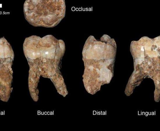 : Human teeth from Qesem Cave. Credit: Prof. Israel Hershkovitz, Tel Aviv University