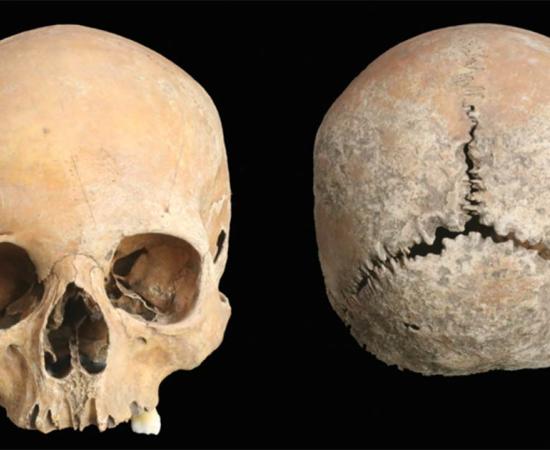 Views of the cleaned Anglo-Saxon woman’s skull.      Source: G. Cole / Antiquity Publications Ltd