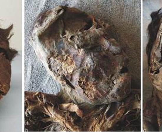 High-impact shocks to the face and skull. Source: Standen et al. / Journal of Anthropological Archaeology