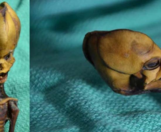 Mummified child found in Chile. 