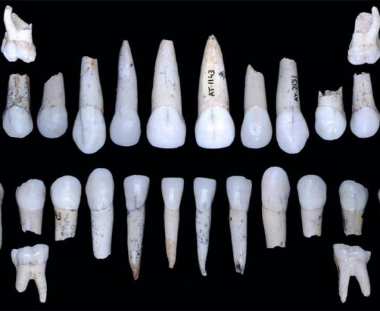 Individual XVIII teeth from la Sima de los Huesos, Atapuerca. Source: M. Modesto-Mata / CENIEH