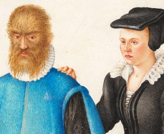 Pedro González and his wife Catherine (c. 1575) by Joris Hoefnagel. Source: Public domain