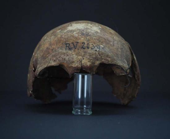 The skull of the man who died infected with an early strain of the bacterium that thousands of years later caused the devastating plague in medieval Europe. Black Death origins have now been pushed much further back in history because of this incredible scientific study.					Source: Dominik Göldner / BGAEU