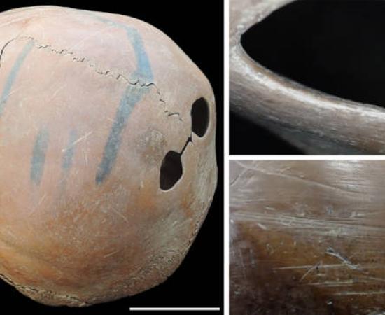 A worked human skull with two precisely drilled perforations in the parietal bones.