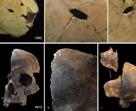 Examples of skulls from the assemblage, with evidence for blunt force trauma and cut marks.	