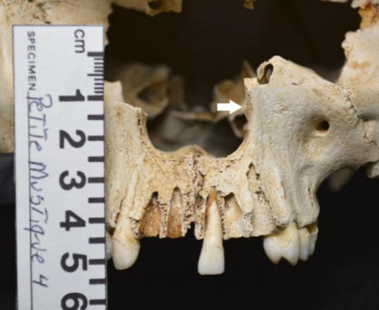 It was this skull, found on the uninhabited island of Petite Mustique in the Caribbean, that was used in the recent leprosy research study.					Source: International Journal of Paleopathology