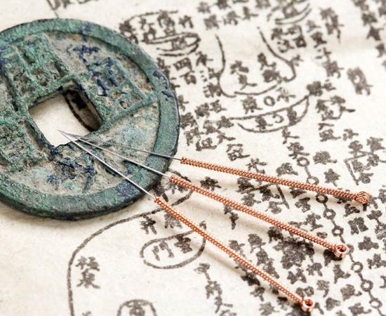 An ancient Chinese anatomy text and acupuncture needles.   Source: Yu Lan / Adobe Stock