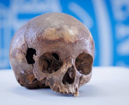Skull recovered from the ruins of Ephess in 1929, which was once thought to belong to Cleopatra’s sister,  Arsinoë IV.