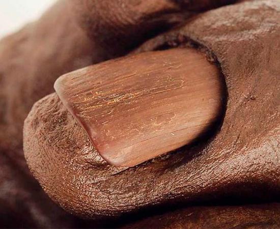 Close up of Old Croghan Man’s nails (National Museum of Ireland)