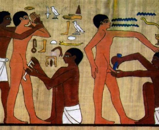 Ancient Egyptian men undergoing circumcision.