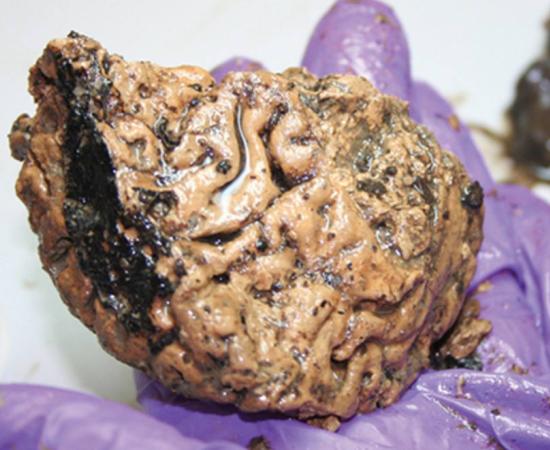 Britain's oldest brain