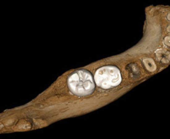 Surface model of the Xiahe mandible after digital removal of the adhering carbonate crust. Source: Jean-Jacques Hublin, ResearchGate.