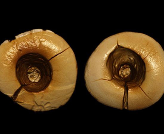A scan of the two teeth with bitumen filling. Credit: Stefano Benazzi