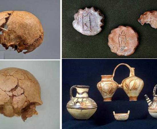 Two views of the broken skull of a young girl who was a probable victim of human sacrifice