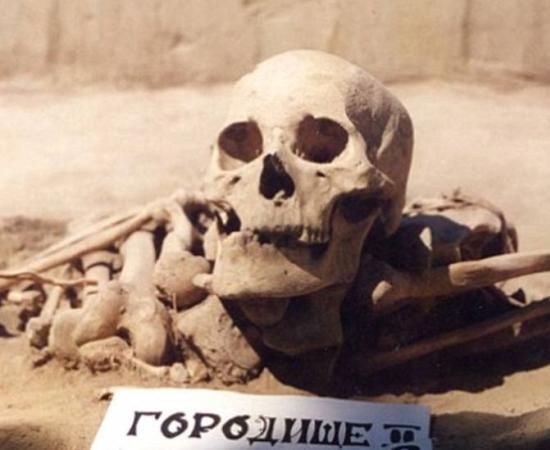 The tell-tale marks on this Early Bronze Age man’s bones reveal cancer is not necessarily a modern phenomenon only