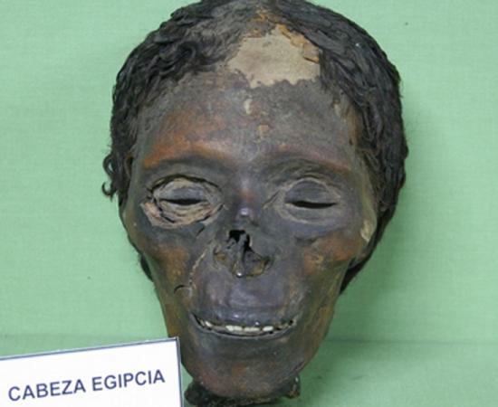 Ancient Egyptian Mummy Head Shows Woman Had Skin Condition Due to Beauty Practice