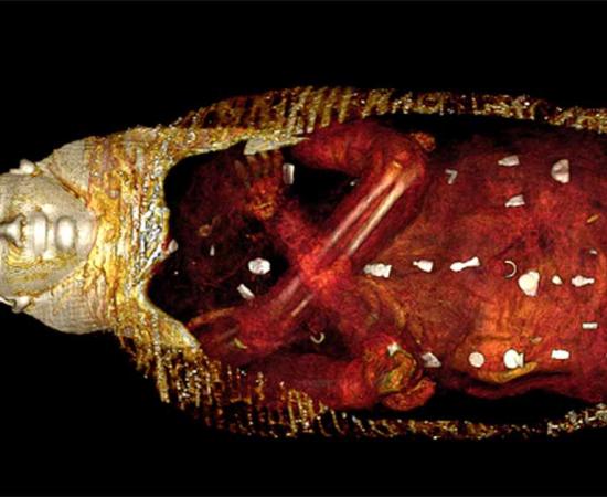 CT images of the mummy revealed amulets were placed on or inside the mummified body of the Golden Boy mummy, including a two-finger amulet discovered next to the boy’s uncircumcised penis. (Saleem, Seddik and el-Halwagy / CC BY 4.0)