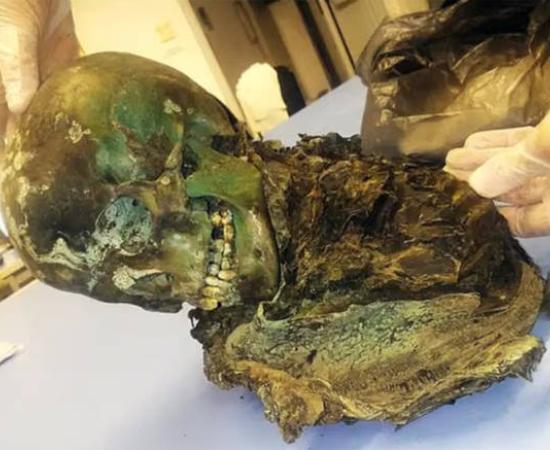 The mummified remains of the teenager, colored green.