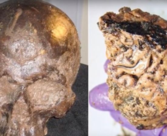 The Heslington skull and brain. Source: Top 5 Scary Videos / YouTube.