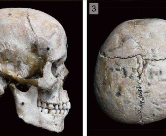 Modified Hirota skull, Japan. Source: Noriko Seguchi/The Kyushu University Museum/PLOS ONE