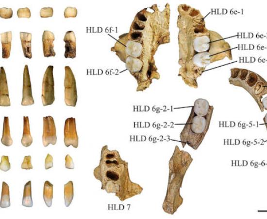 Graphic of the teeth used in the study.
