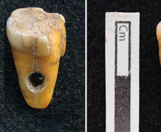The two drilled 8,500-year-old human teeth found at Çatalhöyük in Turkey. Source: Scott D. Haddow / University of Copenhagen