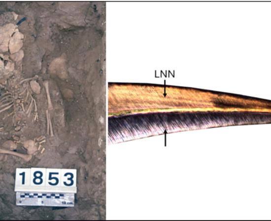 Left, Burial of a perinatal individual from the Fortalesa dels Vilars, Right, baby's central incisor 