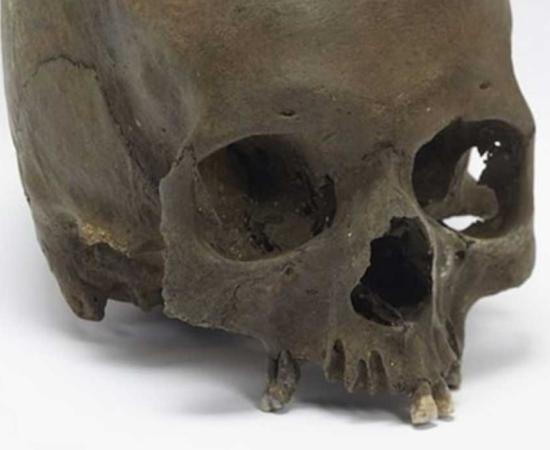 The Iron Age skull was deliberately severed from its body. 