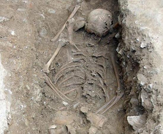 The skeleton of the girl, a little under 5 feet tall and about age 13, showed signs of scurvy and anemia