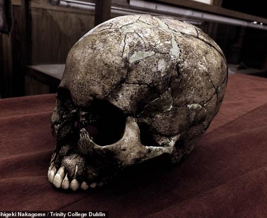 One of the ancient Japanese skulls from which DNA was extracted. Credit: Shigeki Nakagome / Trinity College Dublin