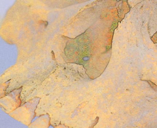 Special imaging of 4,000-year-old skull from which two genomes of Mycobacterium lepromatosis  were sourced.