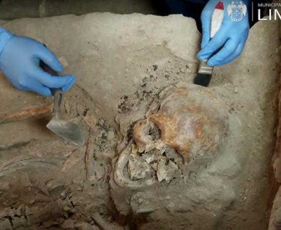 A skull of one of the Spanish syphilis patients who died in Lima’s fist hospital that was built just 20 years after Pizarro took over the Inca Empire.		Source: Municipalidad de Lima