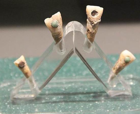 Maya teeth were turned into jeweled teeth by skilled ancient dentists, but a recent study suggests that this also benefited oral hygiene!		Source: Gary Todd / CC0