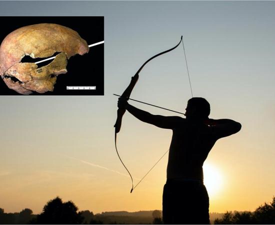 Main: Representation of a man firing a medieval longbow. (Oksana Volina / Adobe stock).     Inset: Exit wounds seen on the cranium used in the study. (Oliver Creighton / University of Exeter)