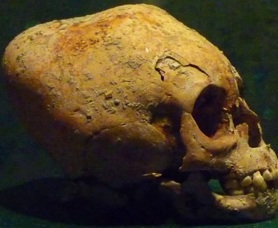 Representative image of a Maya skull with typical more conical style modification.