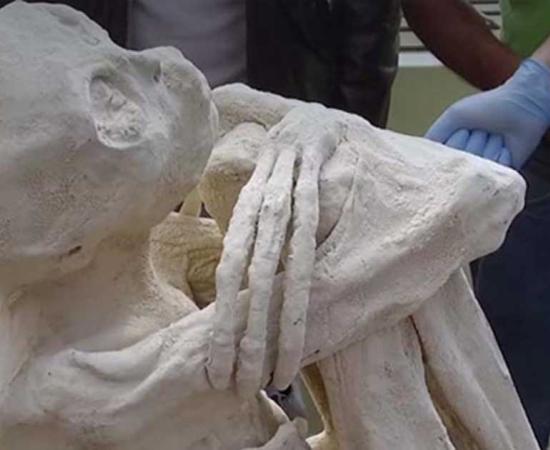 Alleged Mummy found at Nazca, clearly has three fingers and toes