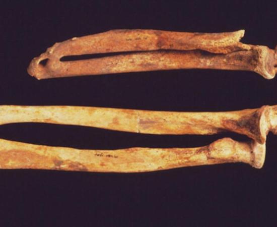 An arm from a body in the cemetery of Ipswich friary